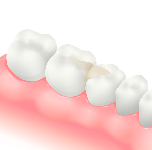 保険のプラスチック