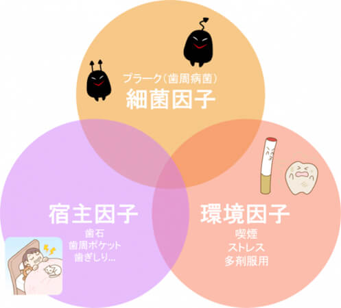 歯周病の原因のイラスト2