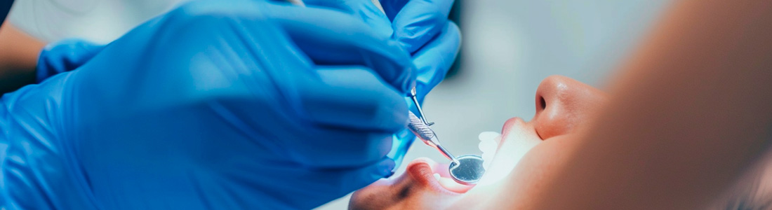 歯の治療をしているイメージ