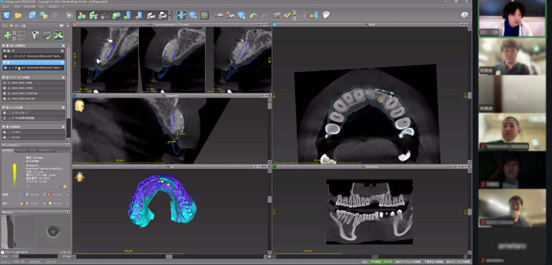 マッチングの様子