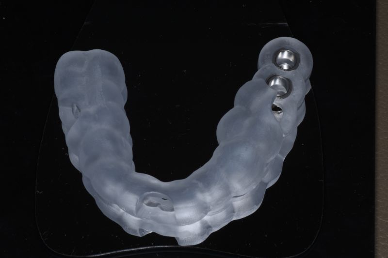 ガイデッドサージェリー